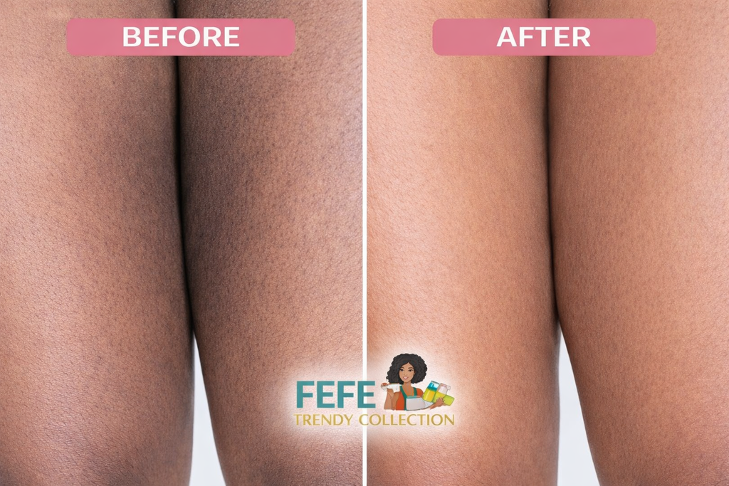 Inner Thigh Brightening Combo
Reveal smoother, brighter, and more even-toned skin with our powerful Inner Thigh Combo—specially designed to target dark spots, hyperpigmentation, and uneven skin tone in delicate areas.